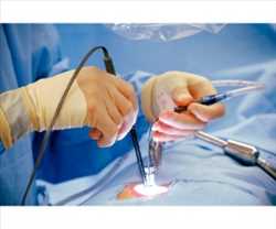 Global Minimally Invasive Surgery Equipment Market